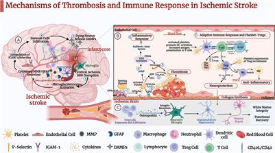 Thrombo-Inflammation and Immunological Response in Ischemic Stroke: Focusing on Platelet-Tregs Interaction